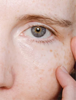 Olho de mulher com pele suave, evidenciando sardas e cuidado facial de cosméticos não nomeados