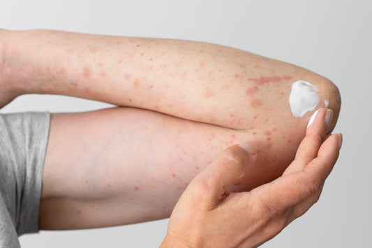 Beneficios da vitamina B3 na rotina de skincare de skincare: Pele saudável e renovada - Unnamed Cosmetics